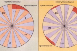 Классификация нарушений менструального цикла