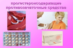 Прогестины при миоме матки