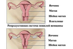 Репродуктивные органы молодой и пожилой женщины