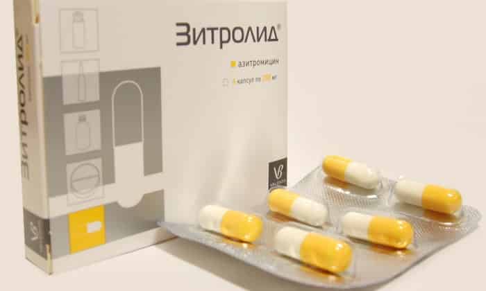 Зитролид для лечения полипов матки