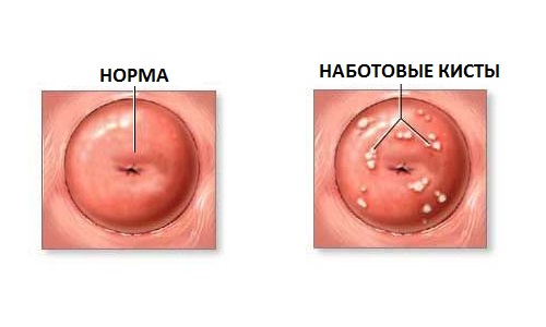 Почему кровит шейка матки при осмотре?