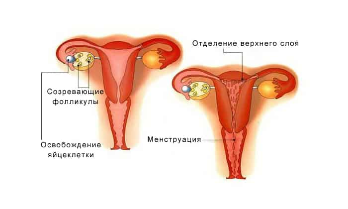 Опасность развития миомы при обильных менструациях