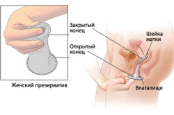 Использование фемидома