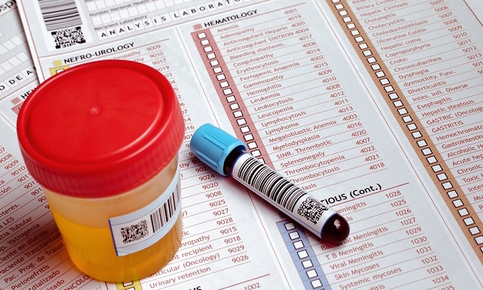 Проведение анализов перед операцией