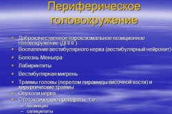 Периферическое головокружение