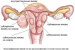 Можно ли принимать витамины В12 при миоме?