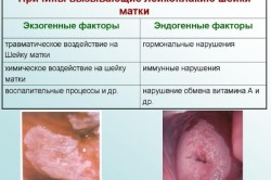 Лейкоплакия - причина развития рака
