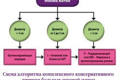 Алгоритм консервативного лечения миомы матки