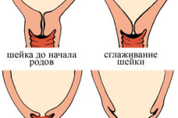 Ощущения женщины при раскрытии шейки матки