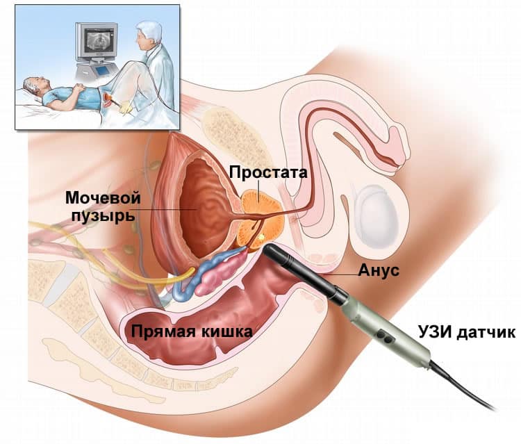 Проведение УЗИ для диагностики маточного кровотечения