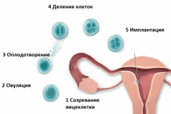 Схема естественного оплодотворения яйцеклетки