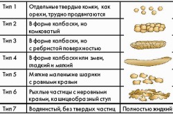 Типы двойни
