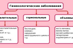Виды гинекологических заболеваний Виды гинекологических заболеваний