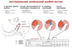 Выделения перед месячными