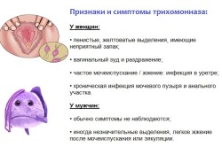 Симптомы и признаки трихомониаза
