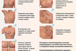 Самообследование молочных желез Самообследование молочных желез
