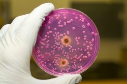 Грибок Candida - причина молочницы