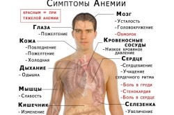 Анемия - симптом полипа эндометрия